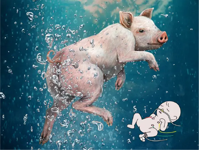 「お尻から呼吸」が命を救う腸呼吸医療機器