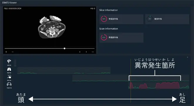 人とAIのハイブリッド救急診療で防ぎ得た死のない世界を実現する