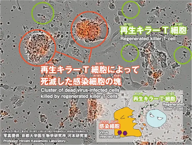 免疫記憶を移植したキラーT細胞でウイルス感染症から人類を救う！